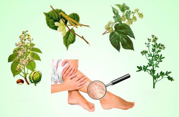 Βότανα που χρησιμοποιούνται για τη θεραπεία των κιρσών στα πόδια