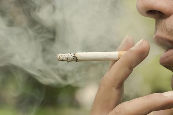 Το κάπνισμα είναι ένας από τους λόγους ανάπτυξης δικτυωτών κιρσών